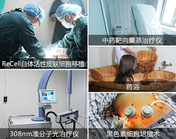 白癜风能吗？