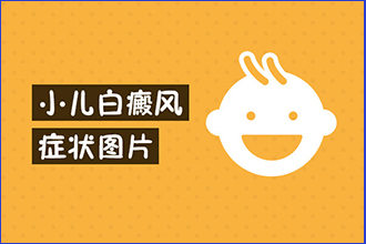 小孩子头顶出现白癞风的症状是什么